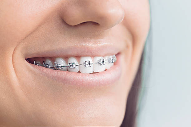 Best Sedation Dentistry  in Ellington, MO